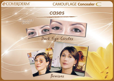 Coverderm Concealer